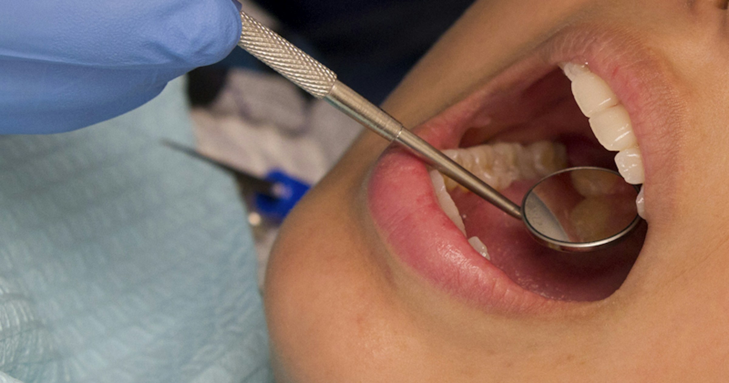 Study: Poor dental health affects brain health
